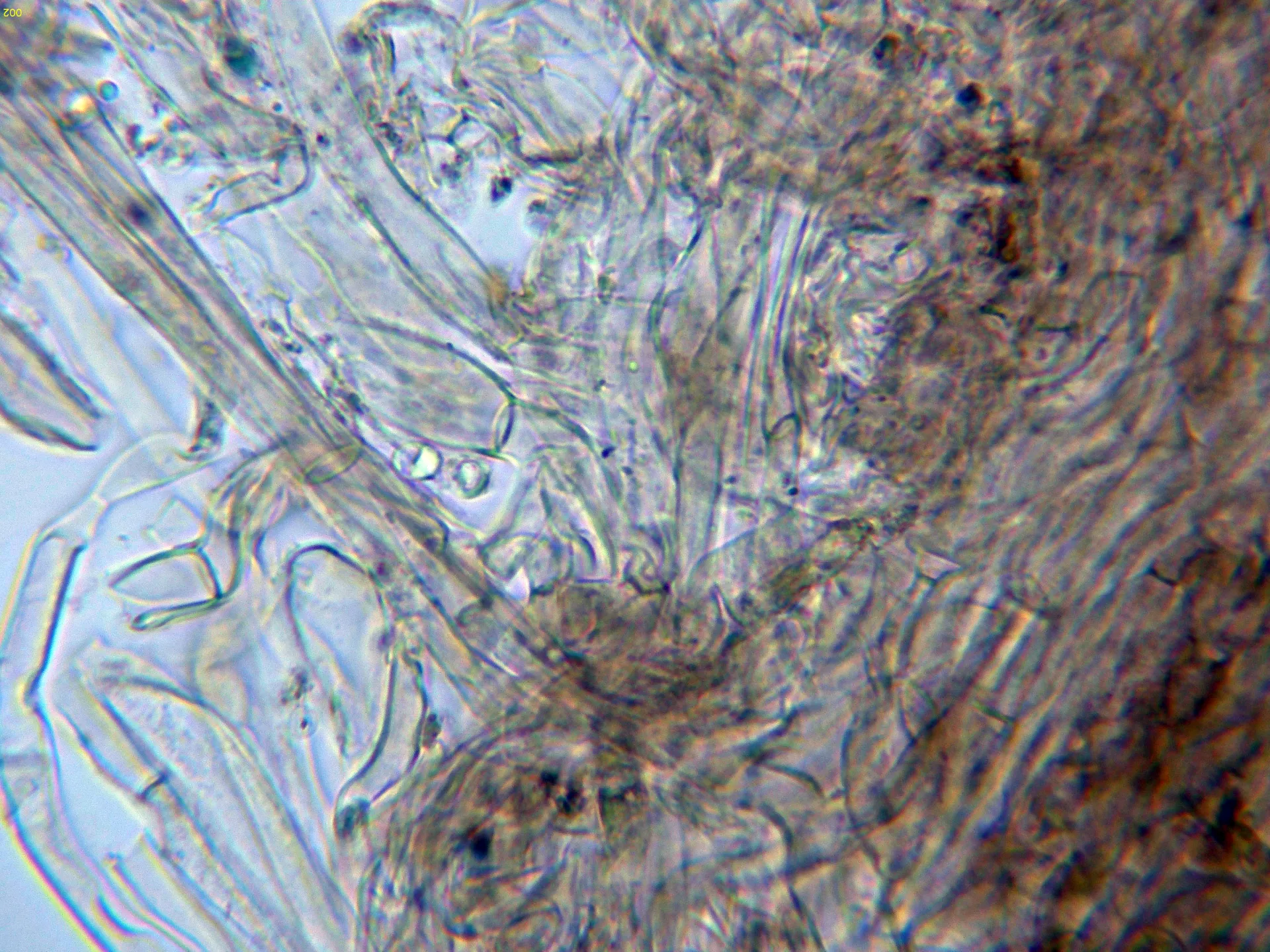 Microscopía de Tricholoma fracticum - 5 - Suprapellis agua-002